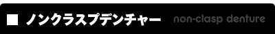 ノンクラスプデンチャー